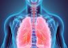 Bệnh ung thư phổi là bệnh gì?
