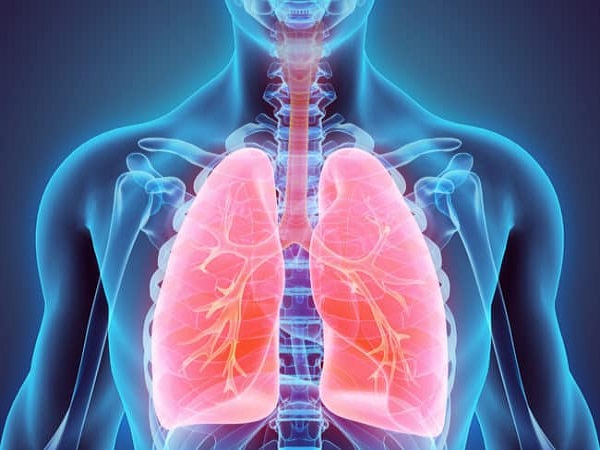 Bệnh ung thư phổi là bệnh gì?